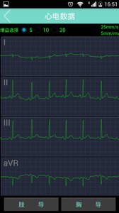 心电专家v3.4.2(3)