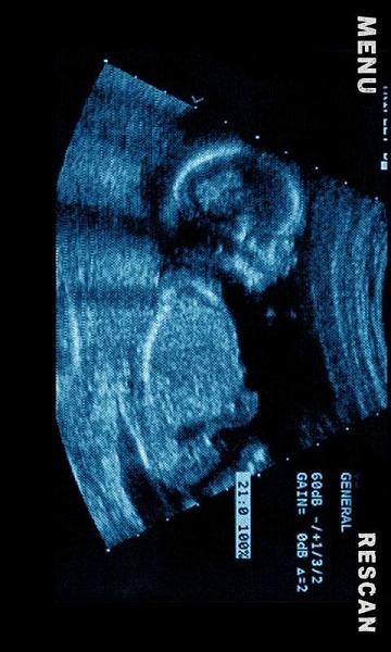 B超手机扫描恶搞apk(1)